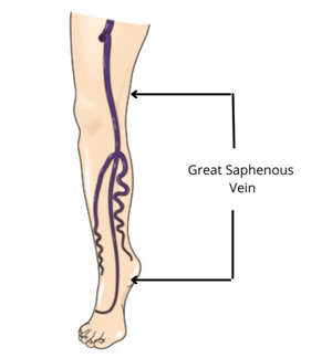 Great Saphenous Vein-1-1